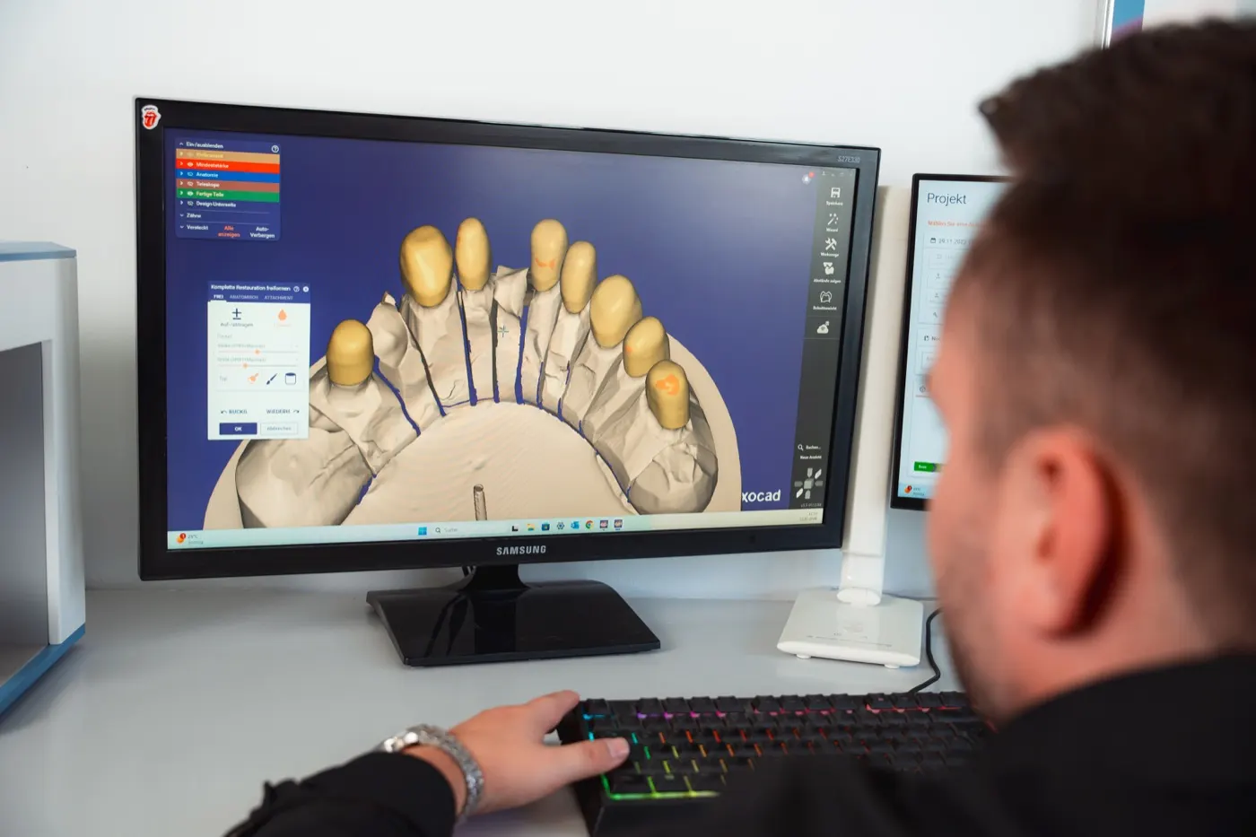 Intraoralscan: erste Leitlinie und ein Tipp für KI-Kronen